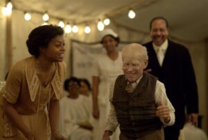 Benjamin Button Disease: Symptoms, Causes, and Real Stories